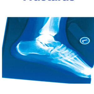 Fracturas